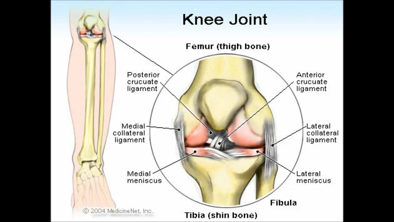 Укол в коленный сустав отзывы пациентов. Внутрисуставные блокады коленного сустава. Техника введения гиалуроновой кислоты в коленный сустав. Внутрисуставное Введение в коленный сустав. Введение гиалуроновой кислоты в коленный сустав.