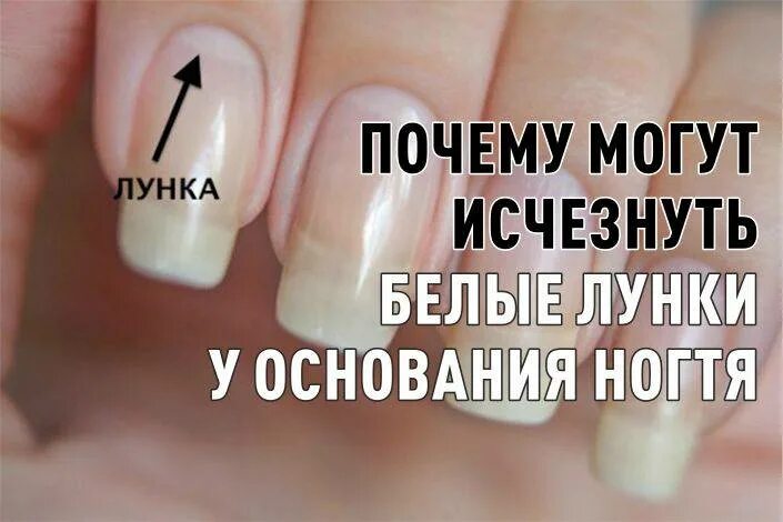Почему исчезли лунки на ногтях. Нормальные лунки на ногтях. о чем говорят ногти. лунки на ногтях здорового человека.