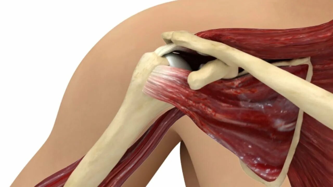 Укороченное сухожилие. Подлопаточная мышца анатомия. МФР подлопаточной мышцы. Подлопаточная мышца плеча. Subscapularis мышца.
