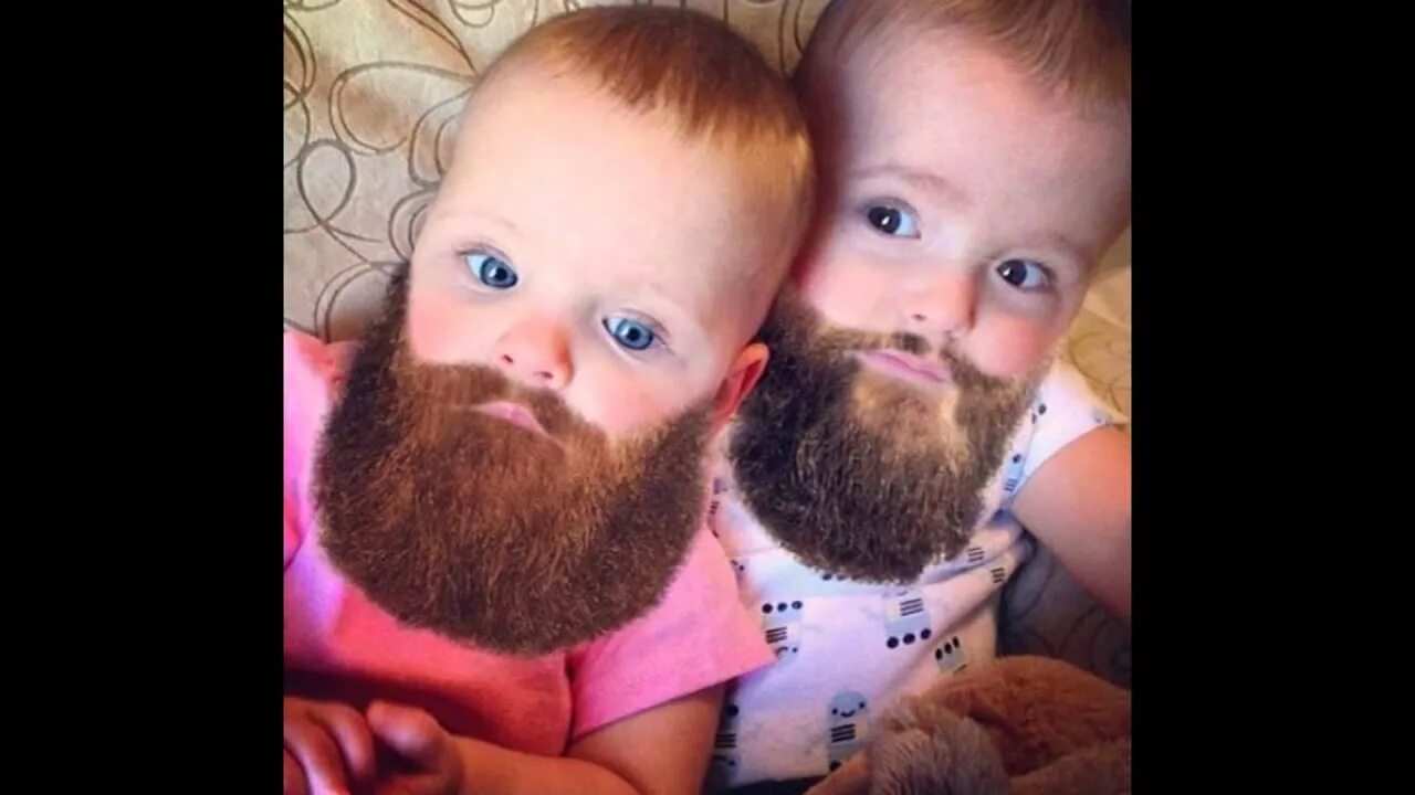 Ребенок с бородой. Бородатый ребенок. Бородатый мальчик. Младенец с бородой.