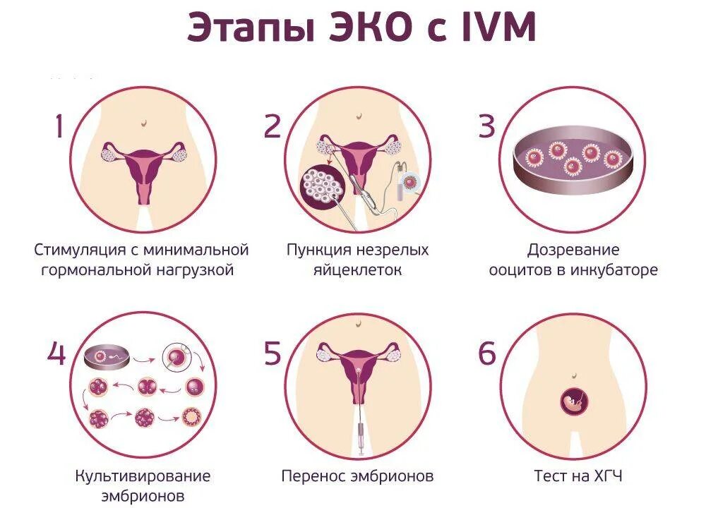 Пункция фолликулов при эко. Перенос эмбрионов при эко. пункция яйцеклеток при эко. рекомендации после пункции яйцеклеток.