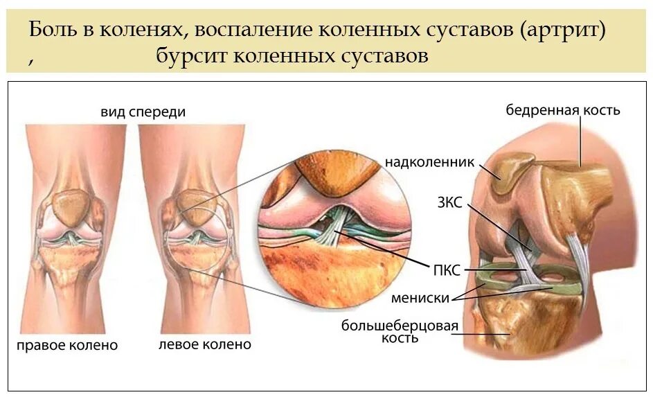 Связи коленного сустава. Крестовидные связки коленного сустава анатомия. Крестообразные связки колена анатомия. Коленный сустав строение мениск. Передняя крестообразная связка коленного сустава передняя.