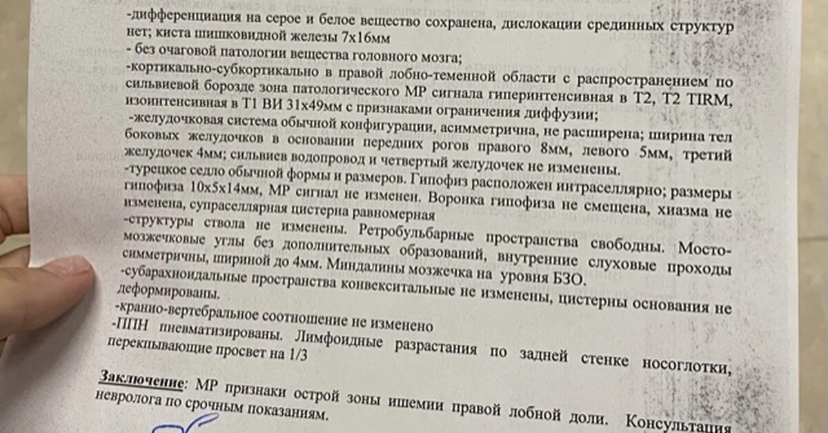 После выписки из больницы после инсульта. Инсульт выписка из истории болезни. Эпикриз больного с ишемическим инсультом. Выписка из истории болезни ишемического инсульта. История болезни ишемический инсульт.