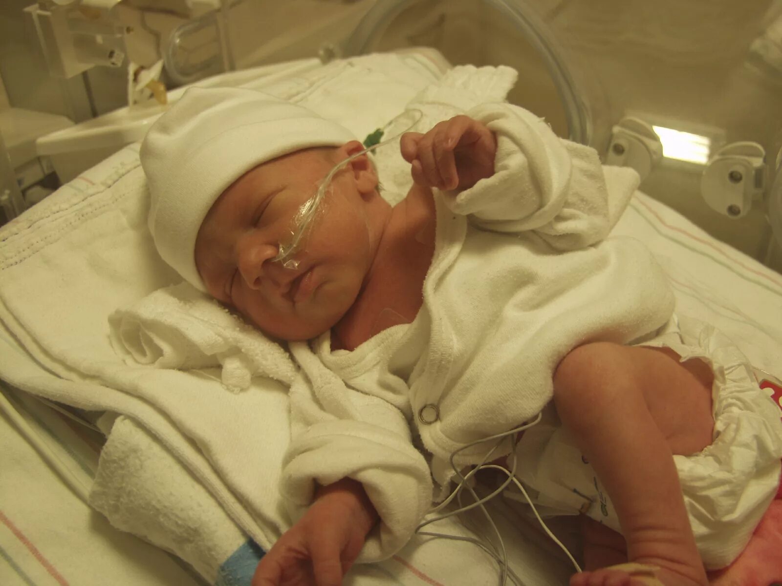 Недоношенный новорожденный. Семимесячный жеребенок. Новорожденный ребенок недоношенные дети.