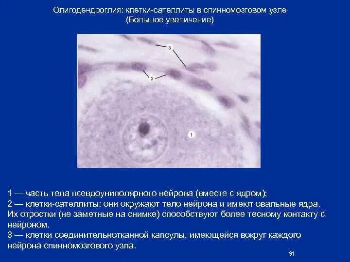 Клетки спинномозгового узла. Псевдоуниполярные Нейроны спинномозгового узла. Псевдоуниполярные нервные клетки (спинномозговой узел).. Ядра клеток сателлитов. Псевдоуниполярные Нейроны спинального ганглия.
