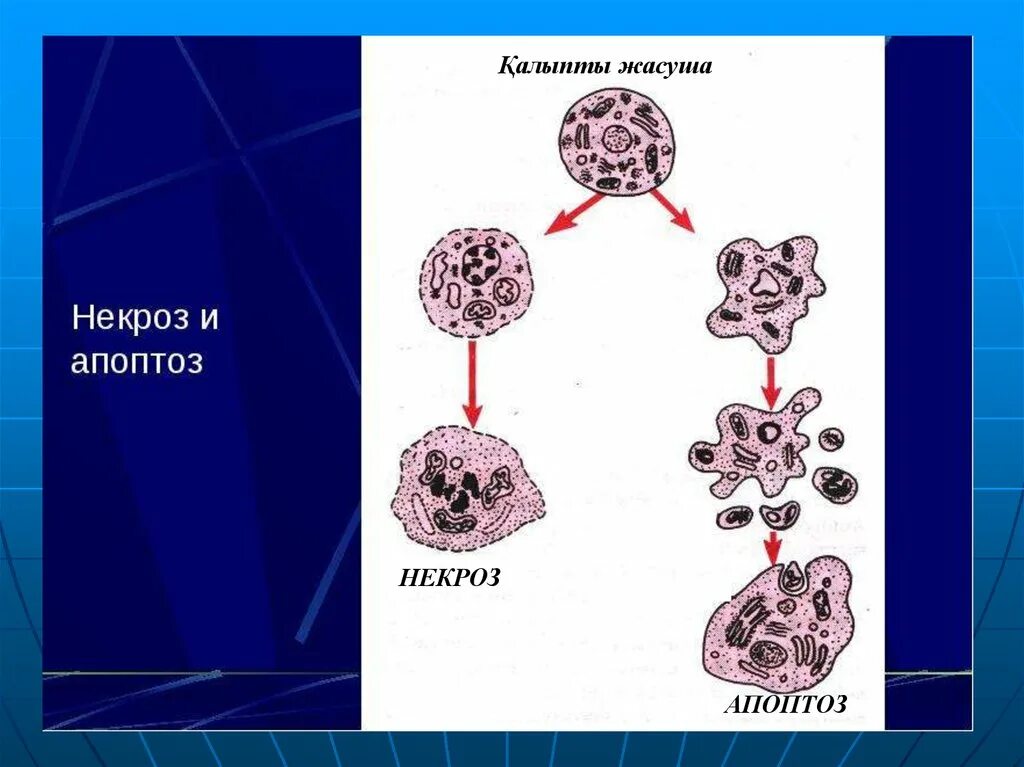 Схема гибели клеток при некрозе и апоптозе. Изменение клетки при некрозе и апоптозе схема. Апоптоз Патохимия. Механизмы гибели клеток апоптоз и некроз.