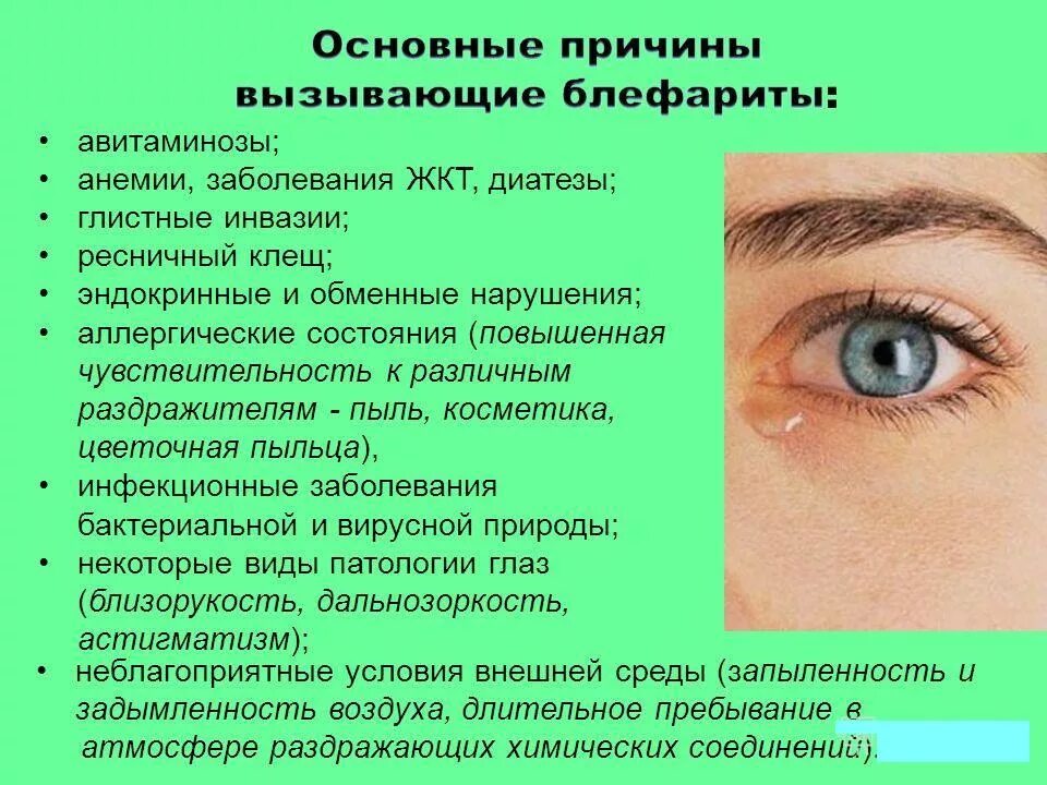 Слезятся глаза как лечить в домашних условиях. Блефарит причины возникновения. Заболевание глаз блефарит.
