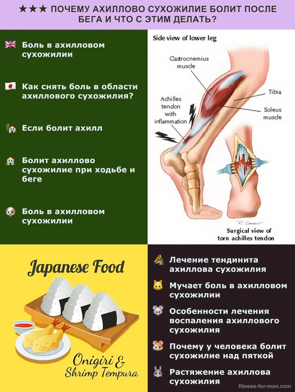 Почему болят сухожилия на ногах