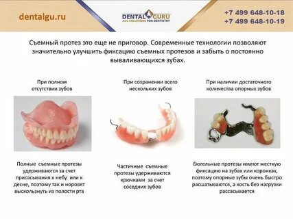 Фиксация полного съемного протеза