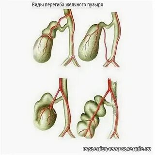Что делать при перекруте
