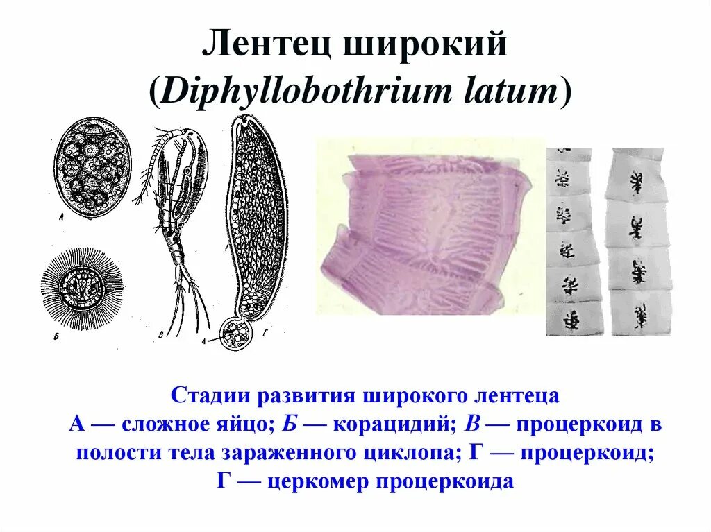 Строение широкого лентеца. Сколекс дифиллоботриоза. строение лентеца широкого diphyllobothrium latum. широкий лентец морфология. лентец широкий сколекс строение.