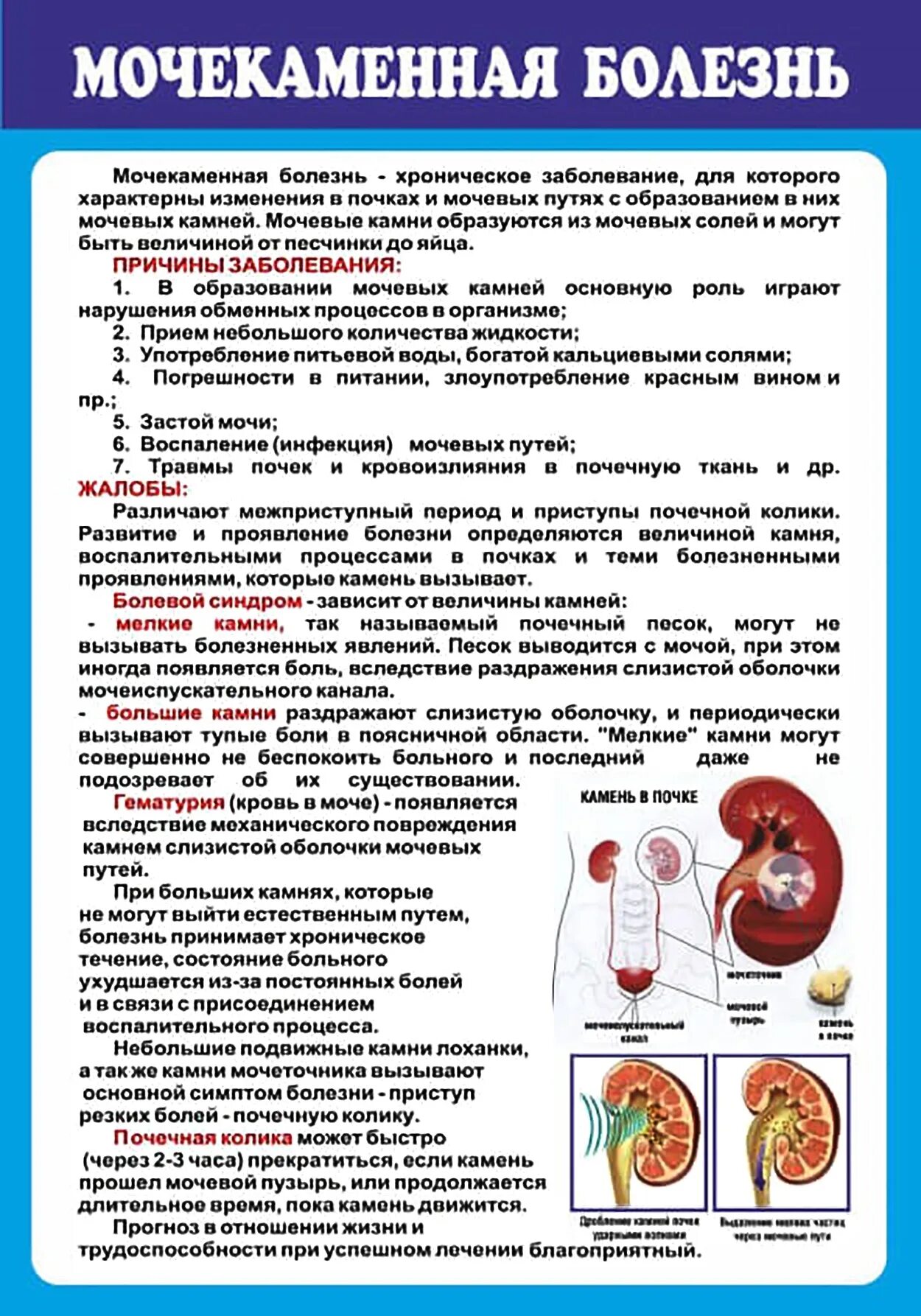 Мочекаменная болезнь причины заболевания. Профилактика болезни почек.мочекаменная болезнь. Заболевания мочевыделительной системы мочекаменная болезнь. Мочекаменная и Почечнокаменная болезнь. Основные клинические проявления мочекаменной болезни.