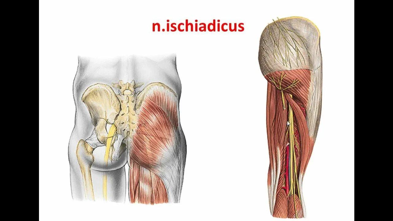 Седалищный нерв (nervus ischiadicu. Нервус ишиадикус. Проекцию n.ischiadicus на бедре.. Седалищный нерв в подколенной ямке.