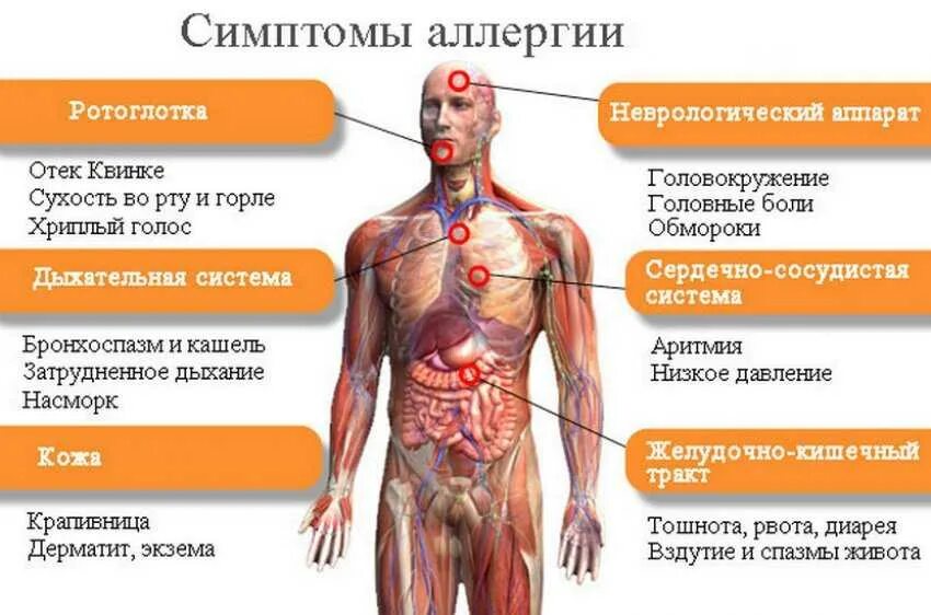 С чем может быть связан сильный. Симптомы проявления аллергии. Аллергическая реакция симптомы.