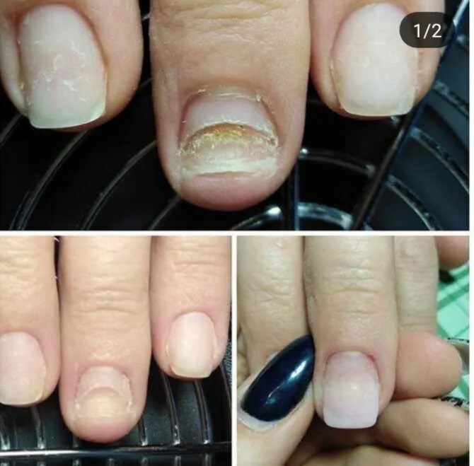 Можно ли использовать поврежденный