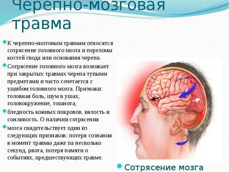 Чем опасно сотрясение. Симптоматика сотрясения головного мозга обуславливается. Три основных признака при сотрясении головного мозга.. Черепно мозговая травма ушиб мозга. Сеоепно мозгоапя Травиа.