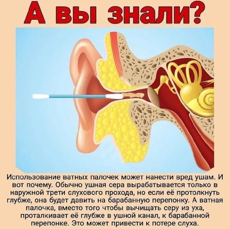 Заложило уши после чистки палочкой. Как правильно чистить уши. чистка ушей ватными палочками. чистить уши ватными палочками.