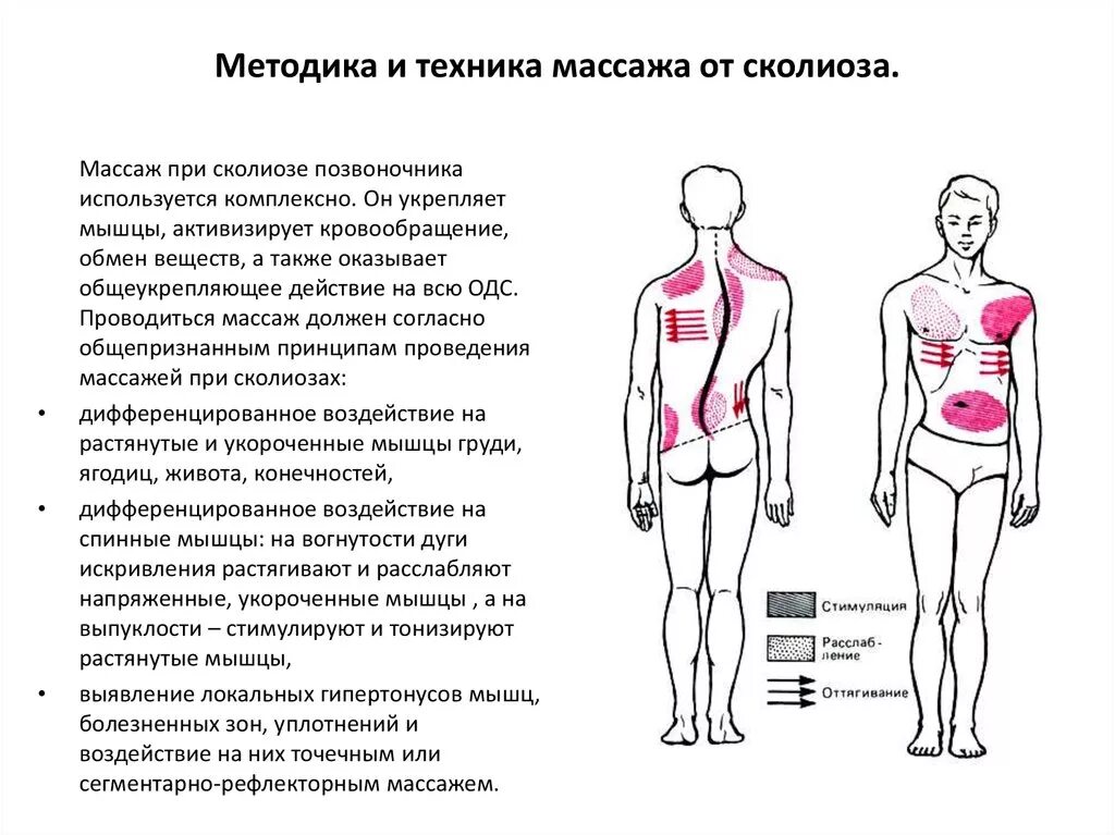 Как лечить мышцы спины. Электростимуляция мышц спины при сколиозе методика. методика массажа при сколиозе 2 степени. методика массажа при сколиозе у детей 10 лет. методика массажа при сколиозе 1 степени.