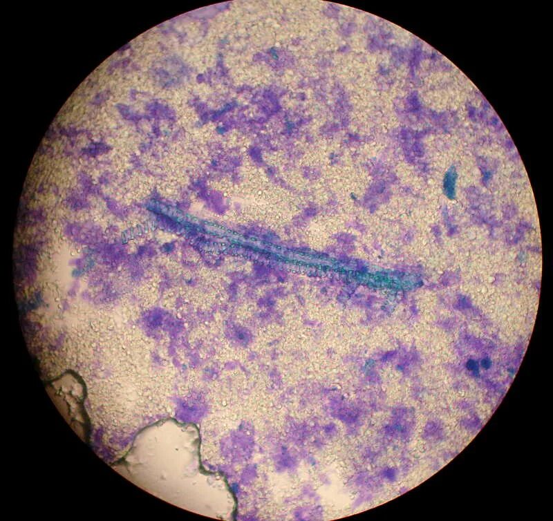 Микропрепарат бактерий. Стрептококк микроскопия. Бифидо бактерии микроскоп. Термофильные молочнокислые стрептококки. Микропрепарат бактерии.
