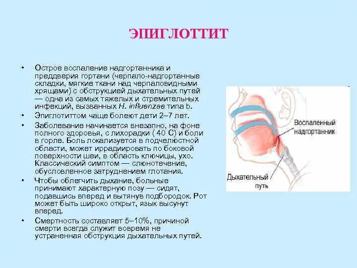 Как выглядит надгортанник у детей Надгортанник рисунок