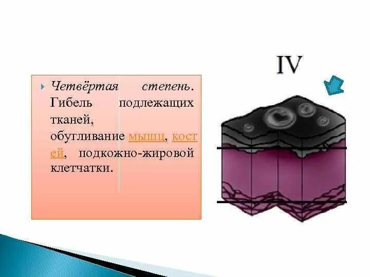 Iv стадия