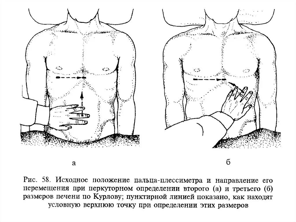 Пальпация печени по курлову. Пальпация селезенки пропедевтика. Перкуссия печени курлову. Пальпация печени по курлову методика. Селезенка по курлову