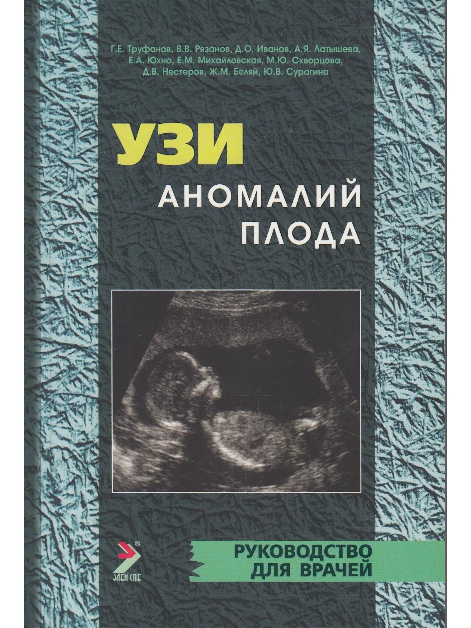 Узи аномалий. Узи книга. учебники по узи. узи руководство. ультразвуковая диагностика плода книга.