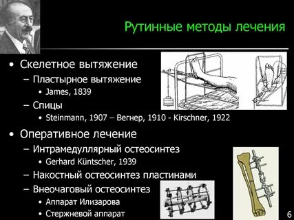 Терапия в травматологии