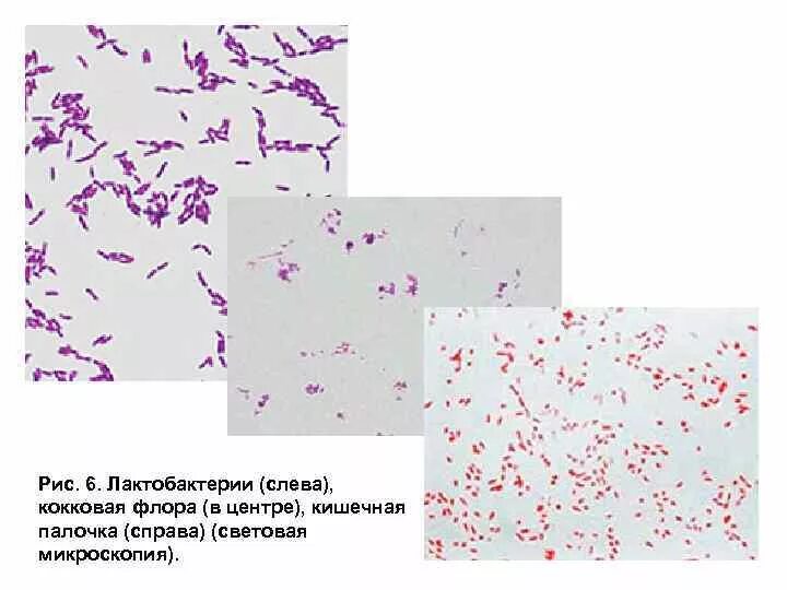 Lactobacillus spp у мужчин. Палочки Дедерлейна микроскопия. Лактобациллы палочки Дедерлейна. Лактобактерии микроскопия.