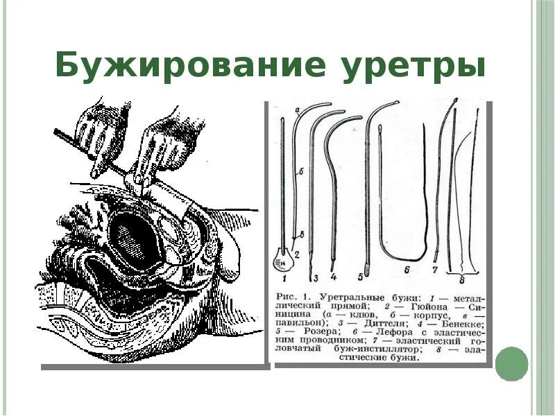 Массаж простаты девушками видео