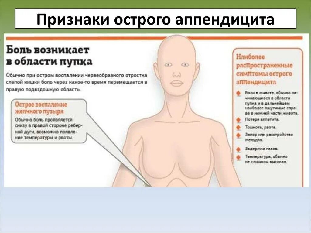 Какая боль больнее. Аппендицит признаки и симптомы. Аппендицит начальные симптомы у женщин. Симптомы аппендицита у женщин.