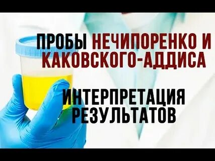 Объем мочи для анализа по нечипоренко
