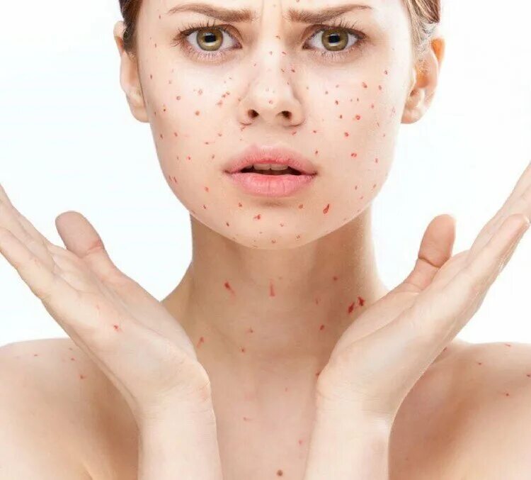 Picking the best healthy skin items to use on your skin inflammation inclined fa