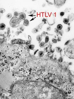 Htlv
