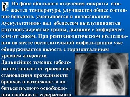 Нарушает ли мокрота пост
