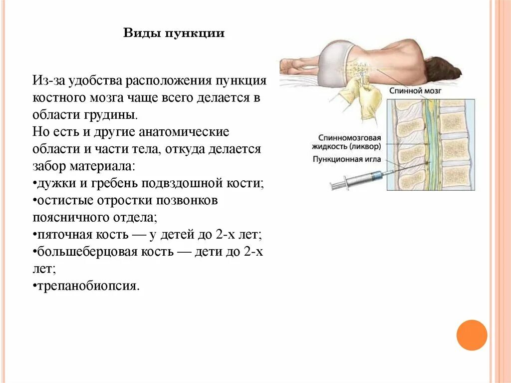 После трепанобиопсии. Взятие пункции костного мозга. Пункция костного мозга грудины что. Анализ пункции костного мозга. Техника пункции грудины для взятия костного мозга..