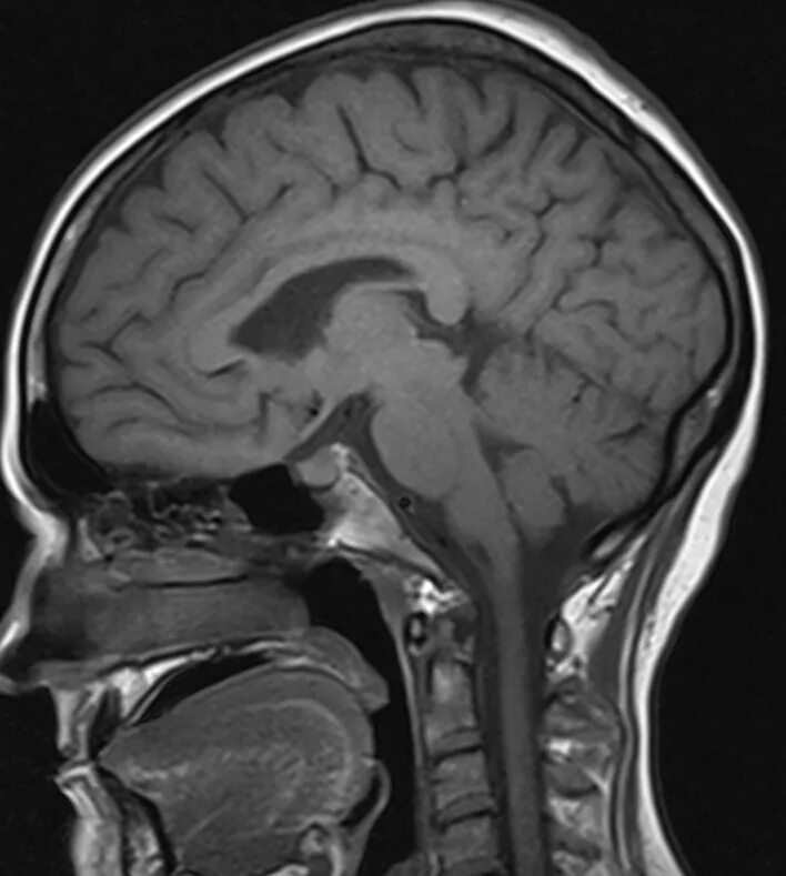 Магнитно резонансные томограммы головного мозга. Диск для снимок мрт южное бутова. Мрт в красноярске павлова 1. Медси аппараты мрт. Мрт головы курган.