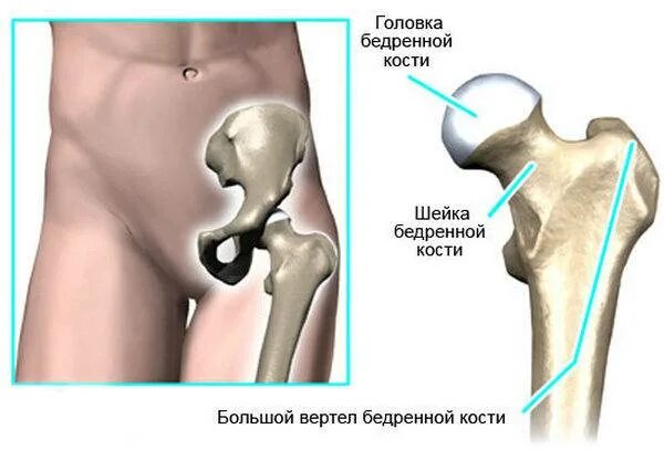 Малый вертел бедренной кости. Бедренная кость большой и малый вертел. Анатомия тазобедренного сустава вертел. Трохантерит тазобедренного сустава . Сухожилия. Шейка бедра в ноге