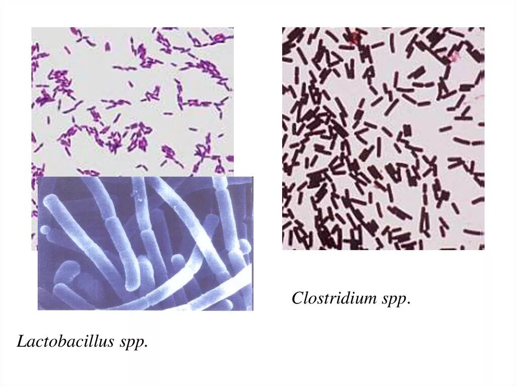 Clostridium spp. Клостридии бактерии. Клостридии микроскопия. Грамположительные бациллы. Клостридии.. Клостридия перфрингенс патогенный.
