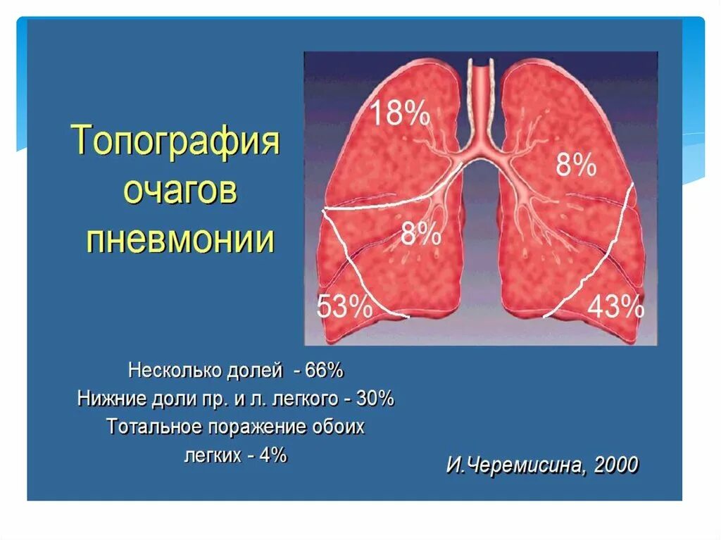 Очаг пневмонии