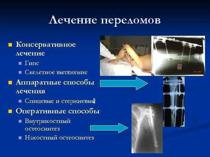 Консервативные методы лечения переломов. Консервативные методы лечения переломов костей. Консервативное и оперативное лечение переломов.