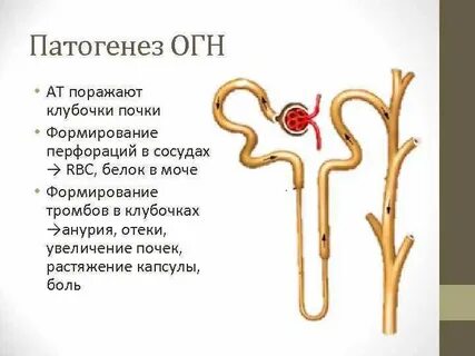 Тельца нефронов