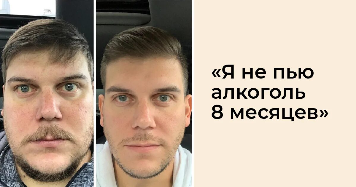 Не пью 7 месяцев. Лицо пьющего и ее пьющего.