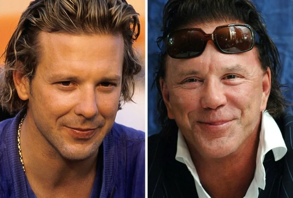 Микки рурк пластические операции. Микки рурк пластические операции. Микки рурк до и после пластики. Микки рурк пластика. Микки рурк пластические операции.