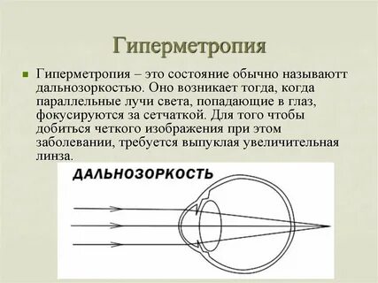 Миопия освобождение