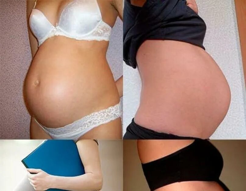 8 5 месяцев беременности