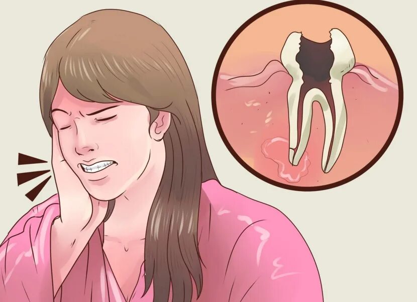 Что делать если ночью сильно болит зуб. Болит зуб. Невыносимая зубная боль.