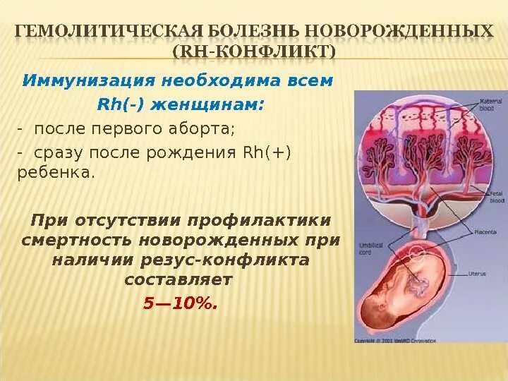 Резус плода анализ. Резус иммунизация. Иммунизация от резус конфликта. Факторы риска резус иммунизации.