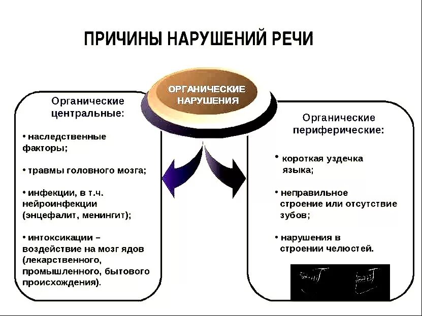 Основные нарушения речи у детей. Причины речевых расстройств у детей. Причины первичных речевых нарушений. Причины первичных речевых нарушений, виды речевых нарушений. Причины речевых расстройств врожденные и приобретенные.