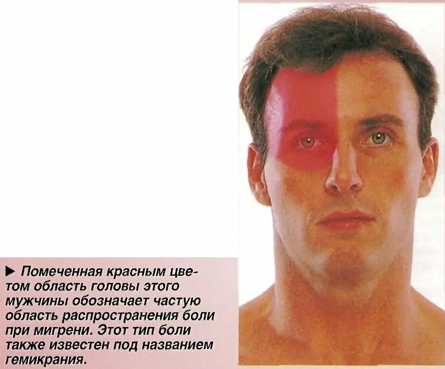 Цефалгия что это такое у взрослых